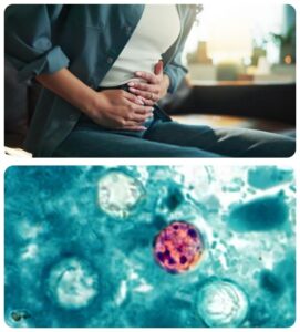 two up collage top photo of a woman holding her stomach, bottom photo of the parasite under a microscope.